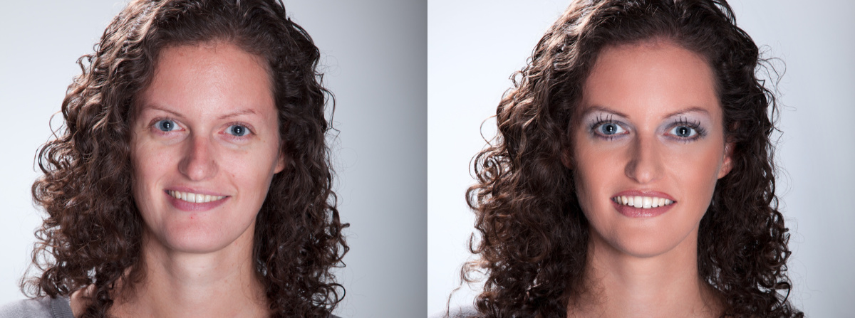 Nasenkorrektur ohne Operation